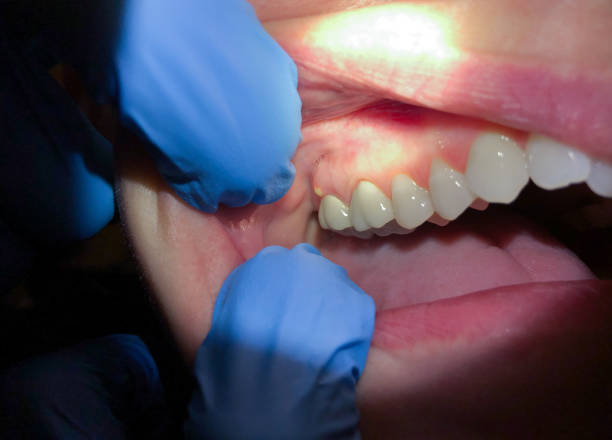 Best Orthodontic Emergency Dentist in Troy, IL