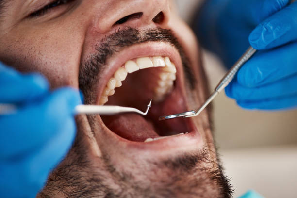 Best Broken or Cracked Tooth Emergency Dentist in Troy, IL
