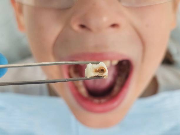 Best Holiday Emergency Dentist in Troy, IL